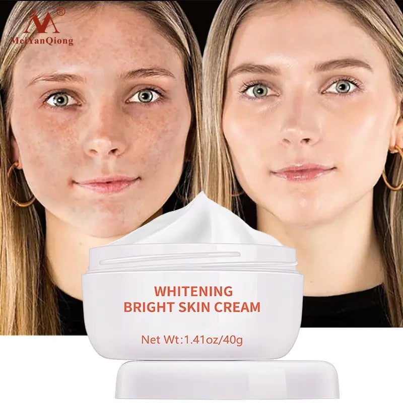 👩 Powerful Whitening Freckle Cream Remove Whitening Freckle Cream Plant Face Cream Remove Freckles and Dark Spots