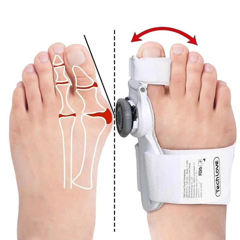 🦶 Bunion Corrector Relief Orthopedic Splint Pads for Hammer Toe Straightener & Protector