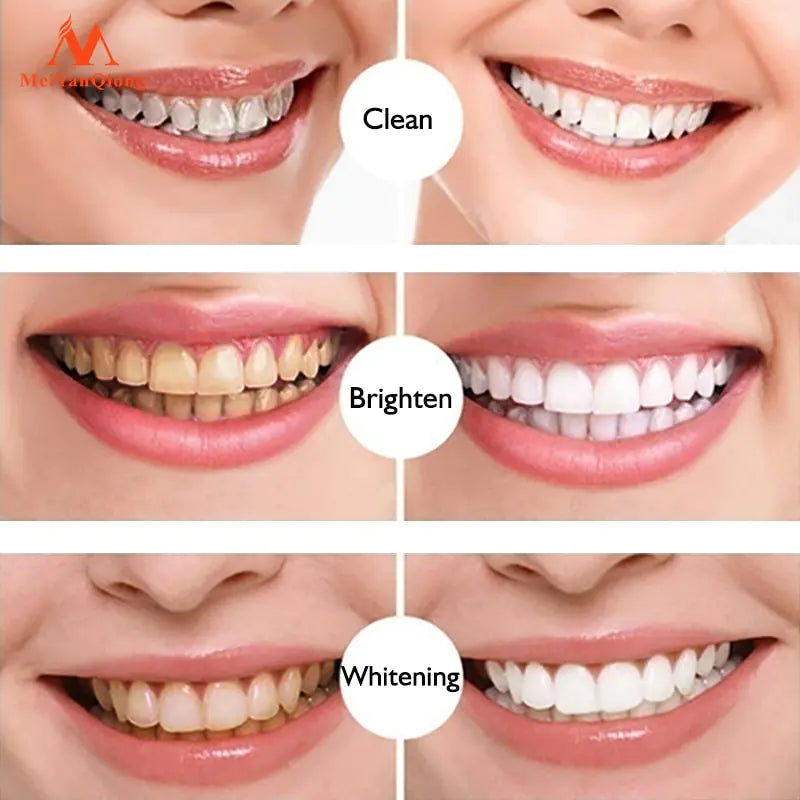 😁 Teeth Whitening Pen Teeth Whitening Gel Professionally Formulated - Best Teeth Whitening Kit Teeth Whitener - Low Sensitivity